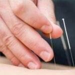 Dr. Glauco Santi Agopuntura e Omeopatia foto